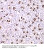 SSRP1 Antibody