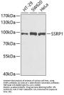 SSRP1 Antibody