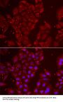 TPP2 Antibody