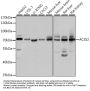 ACSS2 Antibody
