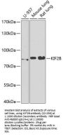 KIF2B Antibody