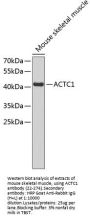 ACTC1 Antibody