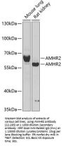 AMHR2 Antibody