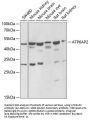 ATP6AP2 Antibody