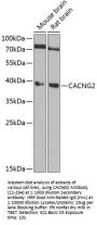 CACNG2 Antibody