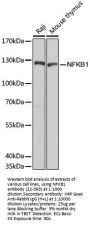 NFKB1 Antibody, KO Validated