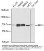 RPN1 Antibody