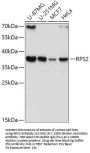 RPS2 Antibody