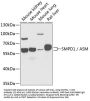 SMPD1 / ASM Antibody