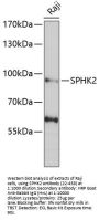 SPHK2 Antibody