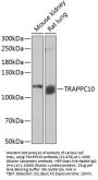 TRAPPC10 Antibody