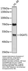 DGAT1 Antibody