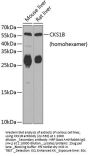 CKS1B Antibody