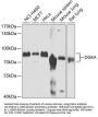 DGKA Antibody