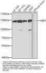 HIP1 Antibody