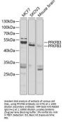 PFKFB3 Antibody