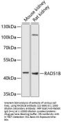 RAD51B Antibody