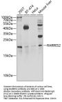 RARRES2 Antibody