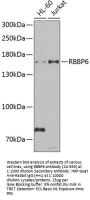 RBBP6 Antibody