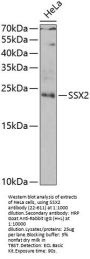 SSX2 Antibody