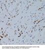 ZNF148 Antibody