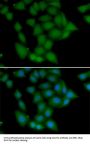 CAMK1 Antibody