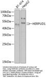 HERPUD1 Antibody