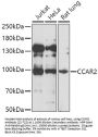 CCAR2 Antibody