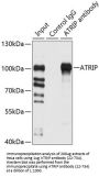 ATRIP Antibody