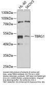 TBRG1 Antibody