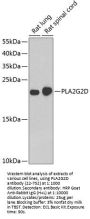 PLA2G2D Antibody