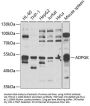 ADPGK Antibody