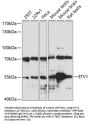 ETV1 Antibody