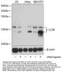 LC3B Antibody, KO Validated
