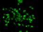 WBSCR22 Antibody