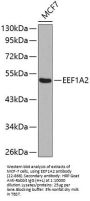 EEF1A2 Antibody