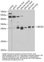 UBE2R2 Antibody