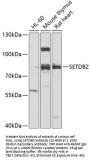 SETDB2 Antibody