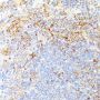 RIPK1 Antibody