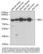 BBS2 Antibody