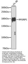 RPGRIP1 Antibody