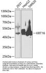 KRT16 Antibody