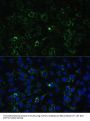 ALDH1A2 Antibody