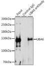 UBA6 Antibody