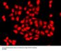 CAMK1D Antibody