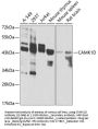 CAMK1D Antibody