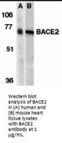BACE2 Antibody