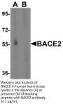 BACE2 Antibody
