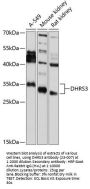 DHRS3 Antibody