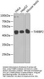 TARBP2 Antibody